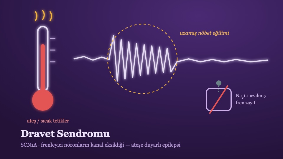 Dravet Sendromu Rehberi: Tanıdan Prognoza, Tedaviden Tedavi Hattına