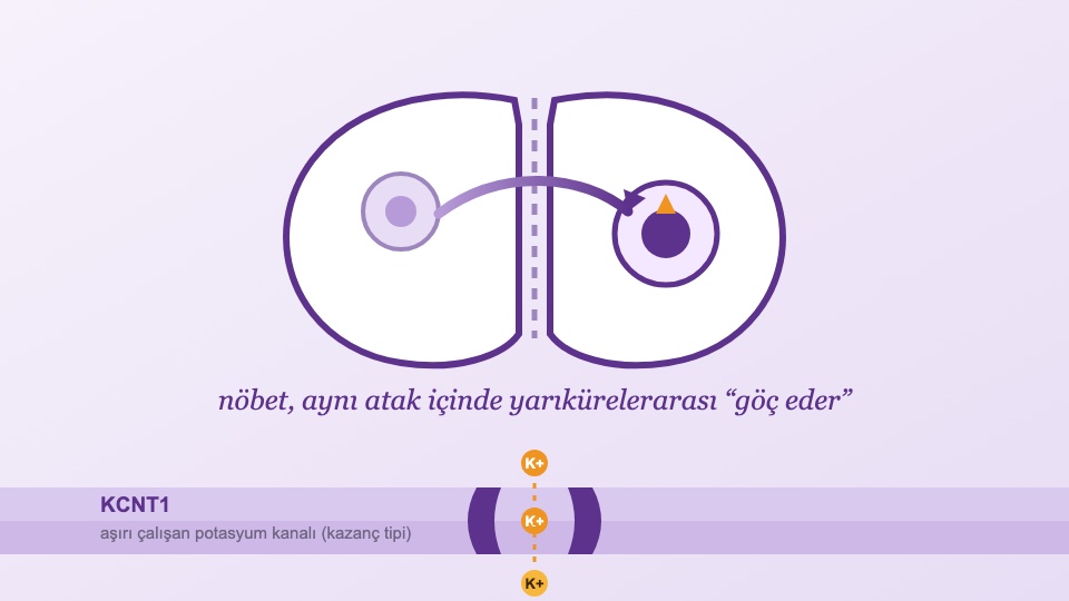 KCNT1 Rehberi: Göç Eden İnfantil Nöbetlerden Uyku Epilepsisine